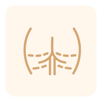 Celulite · Estrias · Gordura